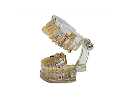 MODELE D ETUDE DENTS MALADES
