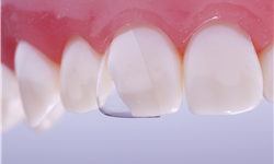 COFORM 11M